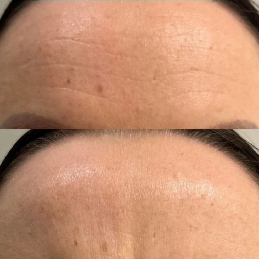 Medicube Collagen Jelly Cream Crème Gelée au Collagène